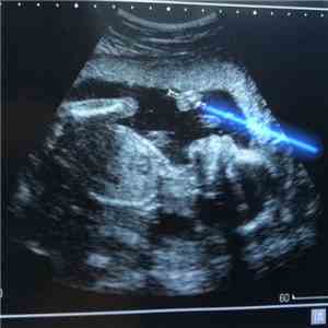 Prototaph - BabyBeatz download free